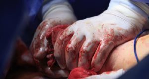 18 Principles Of Bleeding Control