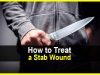 How to Treat a Stab Wound
