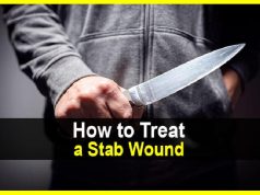 How to Treat a Stab Wound