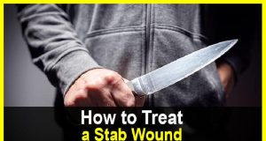 How to Treat a Stab Wound