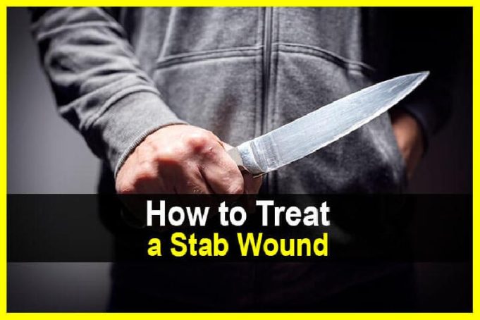 How to Treat a Stab Wound