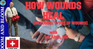 VIDEO: How Wounds Heal