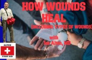 VIDEO: How Wounds Heal