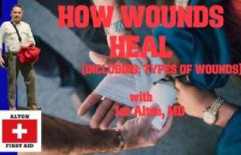 VIDEO: How Wounds Heal