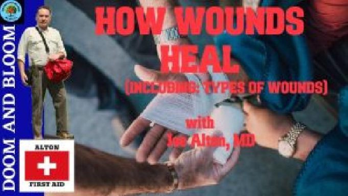 VIDEO: How Wounds Heal