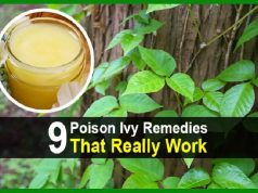9 Poison Ivy Remedies That Really Work