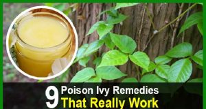 9 Poison Ivy Remedies That Really Work