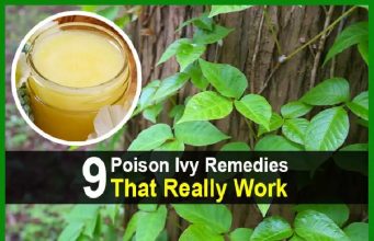 9 Poison Ivy Remedies That Really Work