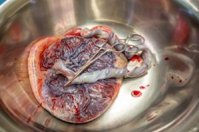 How To Deliver A Placenta After The Baby: Human Birth, Part 3